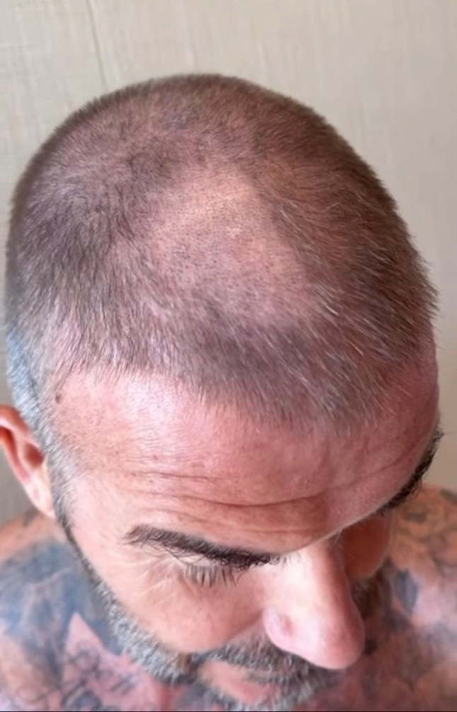 A close up of david beckham's head