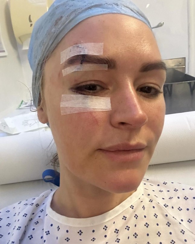 Adam Collard hits back at trolls who claimed he injured sports presenter girlfriend ADAM COLLARD LAURA WOODS Just wanted to explain my absence from the telly for a little while, to be totally transparent and avoid any speculation. I had an accident last weekend at a holiday cottage. I swung a pillow and hit a large, glass lampshade hanging from the ceiling above me, which shattered and cut my face and arms, but luckily missed my eye. I wanted to say a couple of thank yous, firstly to Adam, for being my hero that day, acting so quickly and not leaving my side since and to his family for taking care of me in a time when I was petrified. To my agents Alex Maguire and Matthew Odonohue at CAA who searched for the best help immediately. To Dr Yannis Alexandrides and his wonderful medical assistant Zuzanna at 111 who opened their emergency surgery and came in on their days off, they were so gentle and have already worked magic that I didn?t think was possible to reduce the damage. I?ve added in the photos from then to now to show that even though it may look rough, it?s such a wonderful improvement already and I?m so grateful It was a hell of a shock and I?ve been a bit sad, but I?m feeling very lucky it wasn?t worse. So a big thanks to my eyebrow too, for taking the brunt of it I?m gutted I can?t cover the fight in Riyadh tomorrow anymore, but wishing the brilliant TNT boxing team all the best Be back soon xx 2 d